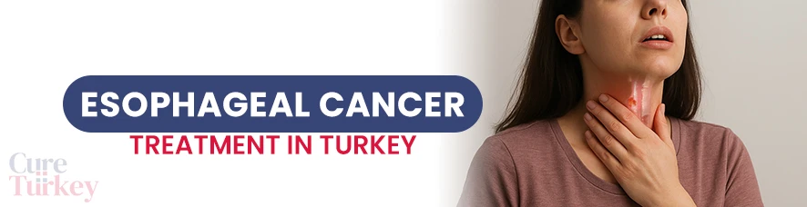 Esophageal Cancer
